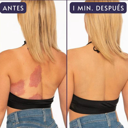 EELHOE™ - Corrector Hidratante corporal