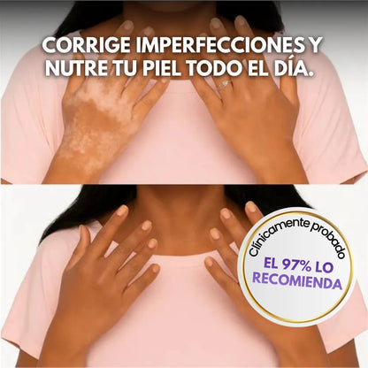 EELHOE™ Corrector Hidratante corporal