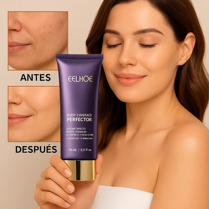 EELHOE™ - Corrector Hidratante corporal