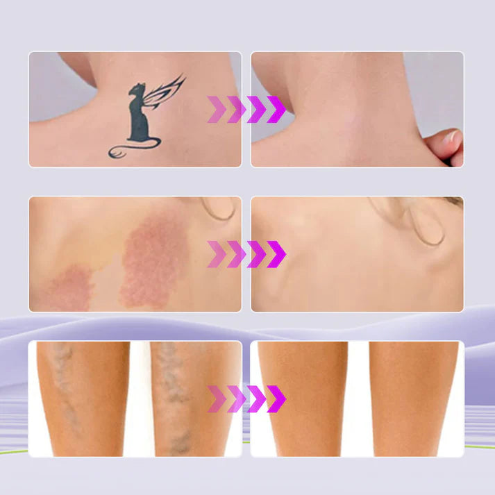 EELHOE™ - Corrector Hidratante corporal