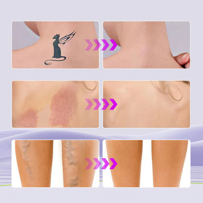 EELHOE™ - Corrector Hidratante corporal